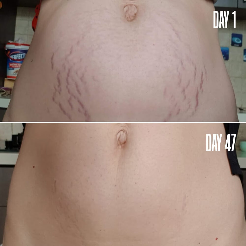 B-FLAT Belly Firming Cream