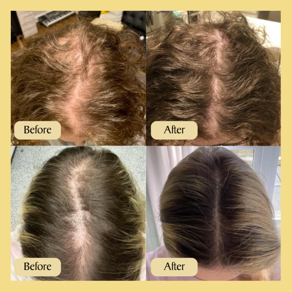 Pure Raw Hair Growth Oil