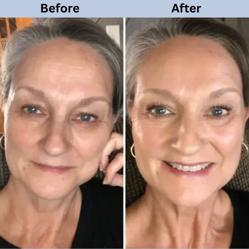 WNP 3% Hyaluronic Acid Serum