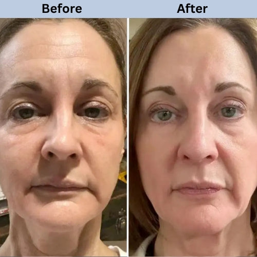 WNP 3% Hyaluronic Acid Serum