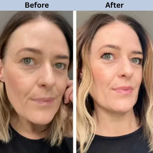WNP 3% Hyaluronic Acid Serum